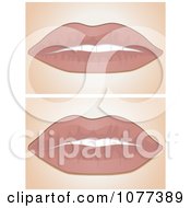 Poster, Art Print Of Before And After Lip Filler Scenes