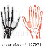 Poster, Art Print Of Xrays Of Human Hands 1