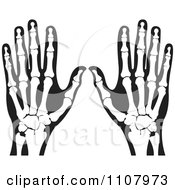 Poster, Art Print Of Xrays Of Human Hands 3