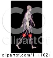 Poster, Art Print Of 3d Xray Of A Walking Overweight Woman With Knee Pain