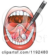 Clipart Of A Dental Mirror Tool In An Open Mouth Royalty Free Vector Illustration