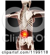 Clipart Of A 3d Medical Female Model With Glowing Lower Back Pain On Black Royalty Free CGI Illustration