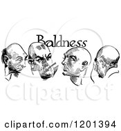 Clipart Of Vintage Black And White Baldness Text Over Four Men Royalty Free Vector Illustration
