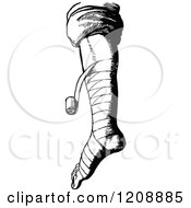 Clipart Of A Vintage Black And White Bandaged Foot And Leg Royalty Free Vector Illustration
