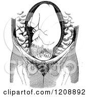 Clipart Of A Vintage Black And White Baby In Cranial Position Royalty Free Vector Illustration