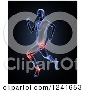 Poster, Art Print Of 3d Female Runner With Highlighted Joint Pain