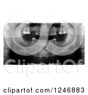 Clipart Of A Dental Xray Royalty Free Illustration