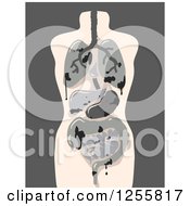 Clipart Of A Model Of Damaged Human Organs Royalty Free Vector Illustration