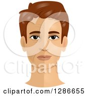 Poster, Art Print Of Brunette White Mans Face Shown Pre And Post A Face Lift Cosmetic Plastic Surgery