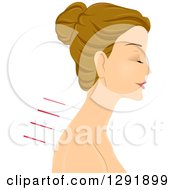 Relaxed Caucasian Woman With Acupuncture Needles In Profile