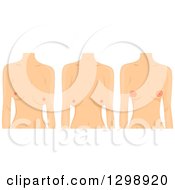 Clipart Of Bodies Of White Women With Different Types Of Breasts Royalty Free Vector Illustration