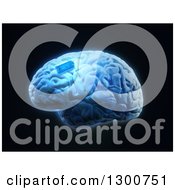Poster, Art Print Of 3d Human Brain With A Blue Implant Chip On Black