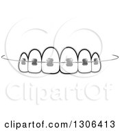 Clipart Of Teeth And Dental Braces Royalty Free Vector Illustration by Lal Perera