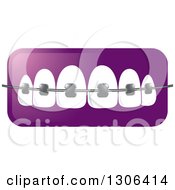 Poster, Art Print Of Gradient Purple Icon Of Teeth And Dental Braces