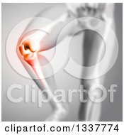 Clipart Of A 3d Anatomical Human Male Skeleton With Red Glowing Knee Pain On Gray Royalty Free Illustration by KJ Pargeter
