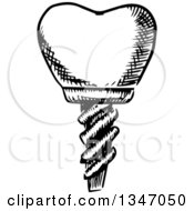 Clipart Of A Black And White Sketched Dental Implant Royalty Free Vector Illustration