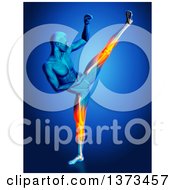 Poster, Art Print Of 3d Blue Anatomical Man Kick Boxing With Visible Glowing Knee And Leg Pain On Blue