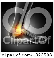 Poster, Art Print Of 3d Closeup Of A Human Foot With Glowing Ankle Bone Pain On Gray