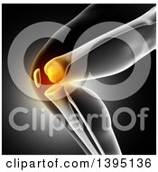 Clipart Of A 3d Xray Of Glowing Knee Pain On Gray Royalty Free Illustration by KJ Pargeter