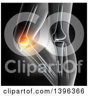Clipart Of A 3d Xray Of Womans Glowing Knee Pain On Gray Royalty Free Illustration by KJ Pargeter