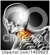 Poster, Art Print Of 3d Xray Anatomical Man With Visible Spine And Glowing Pain Over Gray