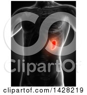 Poster, Art Print Of 3d Anatomical Xray Man With Glowing Red Spleen On Black
