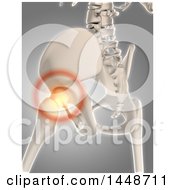 3d Human Skeleton Of A Hip With Glowing Pain On A Gray Background