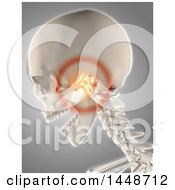Poster, Art Print Of 3d Human Skeleton With Glowing Jaw Pain On A Gray Background
