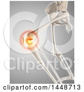 Poster, Art Print Of 3d Human Skeleton Of A Knee With Glowing Pain On A Gray Background