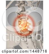 Poster, Art Print Of 3d Human Skeleton Glowing Spinal Pain On A Gray Background
