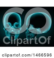 Poster, Art Print Of 3d Front And Side View Of A Skull In Blue Tones