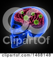 Poster, Art Print Of 3d Profiled Human Skull With Virus Cells Attacking The Brain On Black