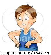 Poster, Art Print Of Boy Sick With Chicken Pox