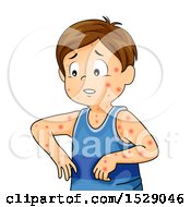 Clipart Of A Boy Sick With Chicken Pox Royalty Free Vector Illustration