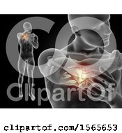 Poster, Art Print Of 3d Xray Man Holding His Painful Elbow On Black