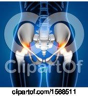 Poster, Art Print Of 3d Woman With Red Highlighted Hip Pain On A Blue Background