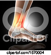 Poster, Art Print Of 3d Closeup Of A Human Foot With Glowing Broken Ankle On Gray
