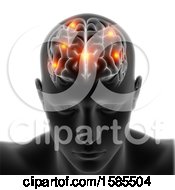 Poster, Art Print Of 3d Xray Male Head With Visible Brainand Highlighted Spots On A White Background