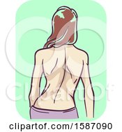 Clipart Of A Woman With A Deformed Back Bone Royalty Free Vector Illustration