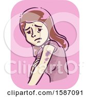 Poster, Art Print Of Woman With Bruises On Her Arms
