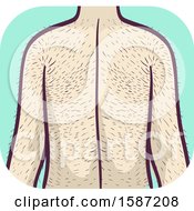 Poster, Art Print Of Man With Excessive Hairy Back And Arms Hypertrichosis Health Problem