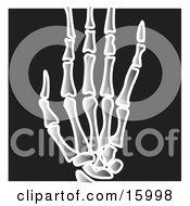 Xray Of Fingers On A Hand Clipart Illustration