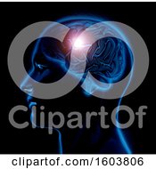 Poster, Art Print Of 3d Render Of A Male Medical Figure With Brain Highlighted On A Black Background