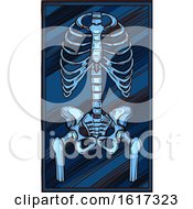 Poster, Art Print Of Skeleton Xray
