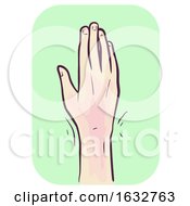 Poster, Art Print Of Hand Symptom Wrist Pain Illustration