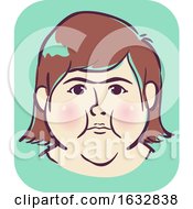 Poster, Art Print Of Girl Symptom Puffy Round Face Illustration