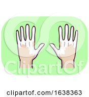 Hands Symptom Loss Of Pigment In Skin Illustration
