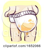 Poster, Art Print Of Baby Diaper Diarrhea Illustration