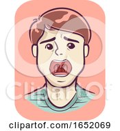 Poster, Art Print Of Boy Symptom Sore Throat Illustration