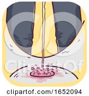 Man Urinate Pink Urine Illustration